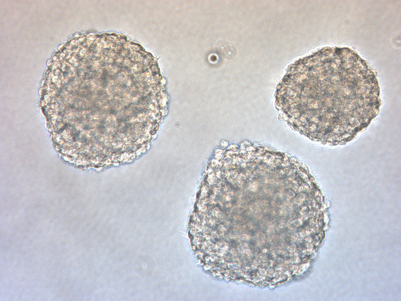 stem_cell1.JPG